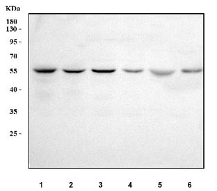 Western blot testing of 1) human Caco-2, 2) human Jurkat, 3) human MCF7, 4) human RT4, 5) rat brain and 6) mouse heart tissue lysate with RAB3IP antibody. Predicted molecular weight ~53 kDa with multiple isoforms.