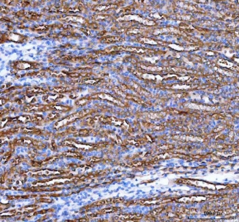 PARD6B Antibody Mouse Kidney IHC. Immunohistochemistry staining of FFPE mouse kidney tissue with PARD6B antibody. HIER: boil tissue sections in pH8 EDTA for 20 min and allow to cool before testing.