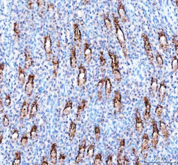 PARD6B Antibody Rat Kidney IHC. Immunohistochemistry staining of FFPE rat kidney tissue with PARD6B antibody. HIER: boil tissue sections in pH8 EDTA for 20 min and allow to cool before testing.