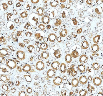 PARD6B Antibody Human Kidney IHC. Immunohistochemistry staining of FFPE human kidney tissue with PARD6B antibody. HIER: boil tissue sections in pH8 EDTA for 20 min and allow to cool before testing.
