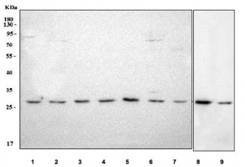 Western blot testing of 1) human A549, 2) human HeLa, 3) human A431, 4) human HepG2, 5) human HaCaT, 6) human MCF7, 7) human HEL, 8) rat RH35 and 9) mouse HEPA1-6 cell lysate with LHPP antibody. Predicted molecular weight ~29 kDa.