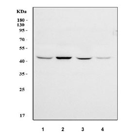 Western blot testing of human 1) HeLa, 2) 293T, 3) HepG2 and 4) K562 cell lysate with ILKAP antibody. Predicted molecular weight ~43 kDa.