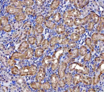 IHC staining of FFPE rat kidney tissue with MCCC2 antibody. HIER: boil tissue sections in pH8 EDTA for 20 min and allow to cool before testing.