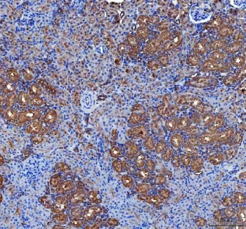 IHC staining of FFPE rat kidney tissue with LIN7C antibody. HIER: boil tissue sections in pH8 EDTA for 20 min and allow to cool before testing.