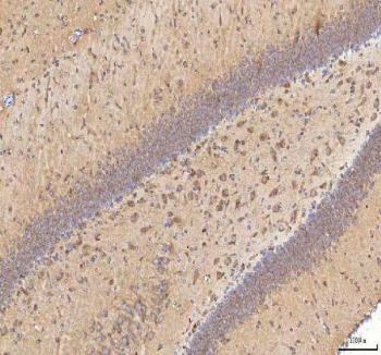 IHC staining of FFPE rat brain tissue with BPNT2 antibody. HIER: boil tissue sections in pH8 EDTA for 20 min and allow to cool before testing.