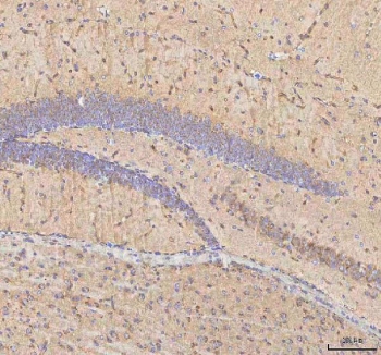 IHC staining of FFPE mouse brain tissue with BPNT2 antibody. HIER: boil tissue sections in pH8 EDTA for 20 min and allow to cool before testing.