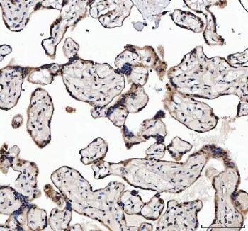 IHC staining of FFPE human placental tissue with MAGEL2 antibody. HIER: boil tissue sections in pH8 EDTA for 20 min and allow to cool before testing.