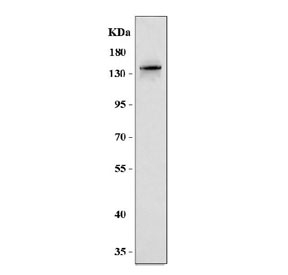 Western blot testing of human U-251 cell lysate with MAGEL2 antibody. Predicted molecular weight ~133 kDa.