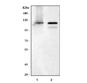 Western blot testing of human 1) HaCat and 2) K562 cell lysate with MAN1 antibody. Predicted molecular weight ~100 kDa, commonly observed at 100-110 kDa.