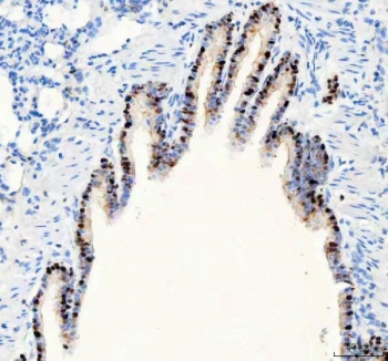 IHC staining of FFPE rat lung tissue with PARP3 antibody. HIER: boil tissue sections in pH8 EDTA for 20 min and allow to cool before testing.