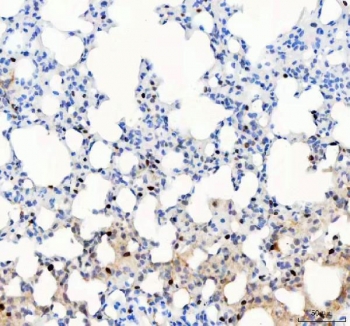 IHC staining of FFPE mouse lung tissue with PARP3 antibody. HIER: boil tissue sections in pH8 EDTA for 20 min and allow to cool before testing.