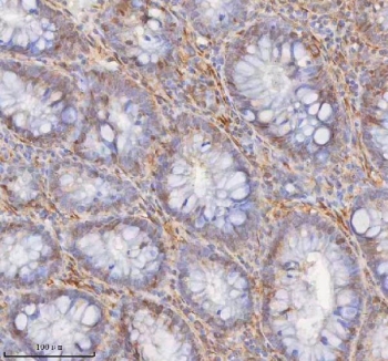 IHC staining of FFPE human colon tissue with SHKBP1 antibody. HIER: boil tissue sections in pH8 EDTA for 20 min and allow to cool before testing.