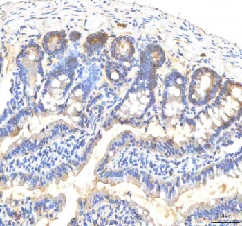 IHC staining of FFPE rat colon tissue with ITPA antibody. HIER: boil tissue sections in pH8 EDTA for 20 min and allow to cool before testing.