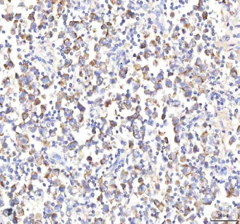 IHC staining of FFPE human testicular seminoma tissue with HEPACAM2 antibody. HIER: boil tissue sections in pH8 EDTA for 20 min and allow to cool before testing.