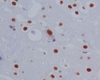 IHC staining of FFPE rat brain tissue with Phospho-STAT3 antibody. HIER: boil tissue sections in pH8 EDTA for 20 min and allow to cool before testing.