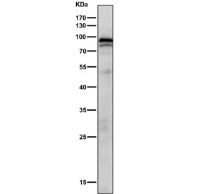 Western blot testing of rat skin tissue lysate with Phospho-STAT3 antibody.