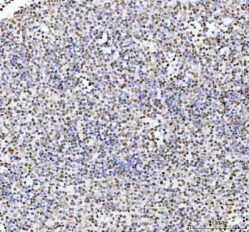 IHC staining of FFPE human spleen tissue with ARID domain-containing protein 1A antibody. HIER: boil tissue sections in pH8 EDTA for 20 min and allow to cool before testing.