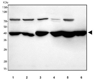 Western blot testing of 1) human 293T, 2) human HepG2, 3) rat liver, 4) rat kidney, 5) mouse liver and 6) mouse kidney tissue lysate with HAOX2 antibody. Predicted molecular weight: ~39 kDa.