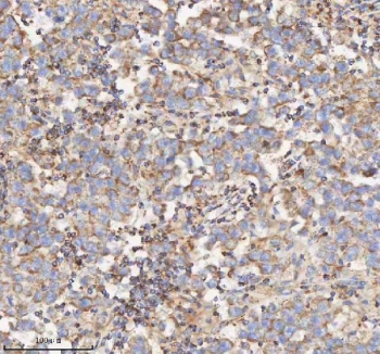 IHC staining of FFPE human testicular seminoma tissue with HADH antibody. HIER: boil tissue sections in pH8 EDTA for 20 min and allow to cool before testing.