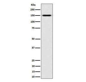 Western blot testing of human K562 cell lysate with NKCC2 antibody. Expected molecular weight: 121-160 kDa depending on glycosylation level. It can also be observed as an ~300 kDa complex with NKCC1.