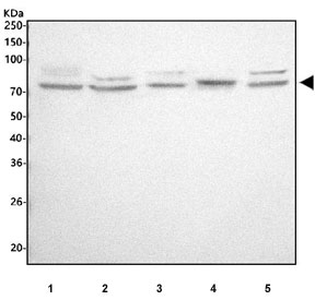 ALOX12 Antibody Human, Rat and Mouse WB. Western blot testing of 1) human A549, 2) human MCF7, 3) human Jurkat, 4) rat RH35, and 5) mouse RAW264.7 cell lysates with ALOX12 antibody. A distinct immunoreactive band is detected at approximately 76 kDa in all samples, consistent with the predicted molecular weight of 12S-Lipoxygenase (ALOX12). The results demonstrate cross-species detection of this arachidonic acid-metabolizing enzyme, which generates bioactive lipid mediators involved in platelet activation, inflammatory signaling, oxidative stress, and regulation of cellular responses.
