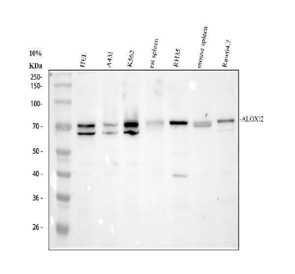 ALOX12 Antibody Human, Rat and Mouse WB. Western blot testing of 1) human HeLa, 2) human A431, 3) human K562, 4) rat spleen, 5) rat RH35, 6) mouse spleen, and 7) mouse RAW264.7 cell lysates with ALOX12 antibody at 0.5 ug/ml. A prominent immunoreactive band is detected at approximately 76 kDa, consistent with the predicted molecular weight of 12S-Lipoxygenase (ALOX12). The results demonstrate cross-species detection of this lipid-metabolizing enzyme, which catalyzes the oxygenation of arachidonic acid to generate bioactive lipid mediators involved in platelet function, inflammation, oxidative stress, and cellular signaling.