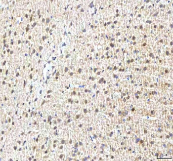 IHC staining of FFPE rat brain tissue with PCMT1 antibody. HIER: boil tissue sections in pH8 EDTA for 20 min and allow to cool before testing.