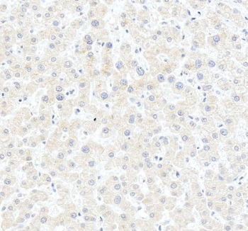IHC staining of FFPE human liver tissue with HSD3B7 antibody, HRP-secondary and DAB substrate. HIER: boil tissue sections in pH8 EDTA for 20 min and allow to cool before testing.