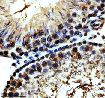 IHC staining of FFPE rat testis tissue with Phospho-MDM2 antibody, HRP-secondary and DAB substrate. HIER: boil tissue sections in pH8 EDTA for 20 min and allow to cool before testing.
