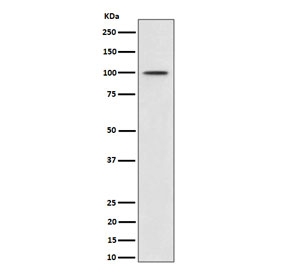 Western blot testing of lysate from human MCF7 cells treated with IGF-1 probed with Phospho-MDM2 antibody.