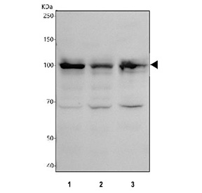 Western blot testing of human 1) MCF7, 2) HepG2 and 3) SH-SY5Y cell lysate with Phospho-MDM2 antibody.