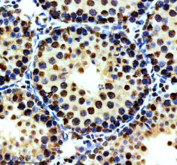 IHC staining of FFPE mouse testis tissue with Phospho-MDM2 antibody, HRP-secondary and DAB substrate. HIER: boil tissue sections in pH8 EDTA for 20 min and allow to cool before testing.