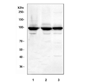 Western blot testing of human 1) 293T, 2) U-251 and 3) Jurkat cell lysate with ST15 antibody. Predicted molecular weight ~106 kDa.
