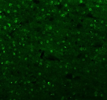 Immunofluorescent staining of FFPE mouse brain tissue with Islet 1 antibody (green). HIER: steam section in pH8 EDTA buffer for 20 min.