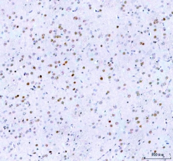 IHC staining of FFPE rat brain tissue with Islet 1 antibody. HIER: boil tissue sections in pH8 EDTA for 20 min and allow to cool before testing.