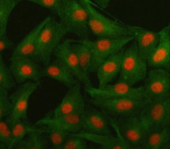 Immunofluorescent staining of FFPE human A549 cells with Islet 1 antibody (red) and Beta Tubulin mAb (green). HIER: steam section in pH6 citrate buffer for 20 min.