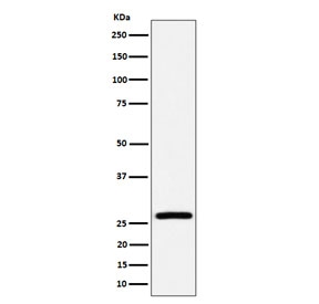 Western blot testing of human HepG2 cell lysate with Adenylate kinase 2 antibody. Predicted molecular weight ~26 kDa.