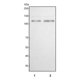 Western blot testing of human 1) RT4 and 2) MCF7 cell lysate with Protocadherin alpha 12 antibody. Predicted molecular weight ~101 kDa.
