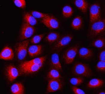 Immunofluorescent staining of FFPE human A549 cells with Intersectin 1 antibody (red) and DAPI nuclear stain (blue). HIER: steam section in pH6 citrate buffer for 20 min.