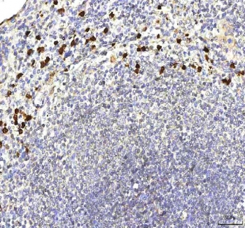 S100A12 Antibody Rabbit Polyclonal in human spleen tissue. Immunohistochemistry staining of FFPE human spleen demonstrates cytoplasmic staining in scattered inflammatory cells consistent with the known expression pattern of S100 calcium binding protein A12 / S100A12 in neutrophils and other myeloid-derived cells. Brown chromogenic signal highlights S100A12-positive inflammatory cells within splenic tissue while surrounding lymphoid cells remain largely negative. Heat-induced epitope retrieval was performed by boiling tissue sections in pH 8 EDTA buffer for 20 min before staining.