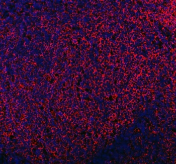 CD206 Antibody Human Tonsil IF. Immunofluorescent staining of FFPE human tonsil tissue using CD206 Antibody / Macrophage Mannose Receptor Antibody demonstrates strong red fluorescence within scattered immune cell populations distributed throughout the lymphoid tissue. The staining pattern is consistent with expression of CD206 (MRC1), a C-type lectin receptor involved in carbohydrate recognition, endocytosis, antigen processing, and macrophage-mediated immune regulation. Positive cells are observed within the tonsillar immune microenvironment, supporting the established role of CD206 as a marker of macrophages and specialized antigen-presenting cell populations. DAPI nuclear counterstain (blue) identifies cell nuclei and tissue architecture. HIER: steam section in pH8 EDTA buffer for 20 min.