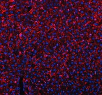 CD206 Antibody Mouse Liver IF. Immunofluorescent staining of FFPE mouse liver tissue using CD206 Antibody / Macrophage Mannose Receptor Antibody demonstrates strong red fluorescence within scattered hepatic immune cell populations and sinusoidal-associated cells throughout the liver parenchyma. The staining pattern is consistent with expression of CD206 (MRC1), a C-type lectin receptor involved in carbohydrate recognition, receptor-mediated endocytosis, antigen processing, and macrophage-mediated immune regulation. Positive immunoreactivity is compatible with resident macrophage populations and other antigen-presenting cells that contribute to hepatic immune surveillance and tissue homeostasis. DAPI nuclear counterstain (blue) identifies cell nuclei and tissue architecture. HIER: steam section in pH8 EDTA buffer for 20 min.