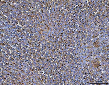 CD206 Antibody Rat Liver IHC. Immunohistochemical staining of FFPE rat liver tissue using CD206 Antibody / Macrophage Mannose Receptor Antibody demonstrates widespread cytoplasmic and membranous HRP-DAB brown staining throughout hepatic sinusoidal-associated cells and scattered immune cell populations. The staining pattern is consistent with expression of CD206 (MRC1), a C-type lectin receptor involved in carbohydrate recognition, receptor-mediated endocytosis, antigen processing, and macrophage-mediated immune regulation. Positive immunoreactivity is compatible with resident hepatic macrophages and other antigen-presenting cell populations that contribute to liver immune surveillance, clearance of glycosylated ligands, and maintenance of tissue homeostasis. HIER: boil tissue sections in pH8 EDTA for 20 min and allow to cool before testing.