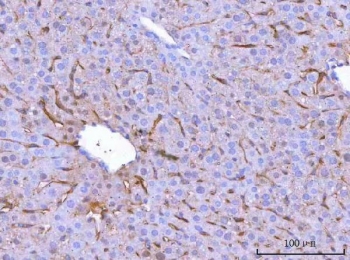 CD206 Antibody Mouse Liver IHC. Immunohistochemical staining of FFPE mouse liver tissue using CD206 Antibody / Macrophage Mannose Receptor Antibody demonstrates distinct cytoplasmic and membranous HRP-DAB brown staining within sinusoidal-associated cells and scattered hepatic immune cell populations. The staining pattern is consistent with expression of CD206 (MRC1), a C-type lectin receptor that mediates carbohydrate recognition, receptor-mediated endocytosis, antigen uptake, and macrophage-associated immune functions. Positive immunoreactivity is observed throughout the liver parenchyma and is compatible with resident macrophage populations involved in immune surveillance, clearance of extracellular material, and maintenance of hepatic homeostasis. HIER: boil tissue sections in pH8 EDTA for 20 min and allow to cool before testing.