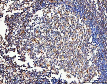 CD206 Antibody Human Tonsil IHC. Immunohistochemical staining of FFPE human tonsil tissue using CD206 Antibody / Macrophage Mannose Receptor Antibody demonstrates distinct cytoplasmic and membranous HRP-DAB brown staining within scattered immune cell populations distributed throughout the lymphoid tissue. The staining pattern is consistent with expression of CD206 (MRC1), a C-type lectin receptor involved in carbohydrate recognition, receptor-mediated endocytosis, antigen processing, and macrophage-mediated immune regulation. Positive immunoreactivity is observed in cells compatible with macrophage and antigen-presenting cell populations within the tonsillar microenvironment, supporting the established role of CD206 as a marker of innate immune cell function and tissue immune surveillance. HIER: boil tissue sections in pH8 EDTA for 20 min and allow to cool before testing.