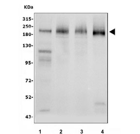 CD206 Antibody Human Monkey Mouse Rat WB. Western blot analysis of 1) rat lung, 2) mouse lung, 3) human liver, and 4) monkey lung tissue lysates using CD206 Antibody / Macrophage Mannose Receptor Antibody. A strong immunoreactive band is detected at approximately 180-200 kDa in all samples, consistent with expression of CD206 (MRC1), a heavily glycosylated C-type lectin receptor involved in carbohydrate recognition, receptor-mediated endocytosis, antigen processing, and macrophage-mediated immune regulation. Although the predicted molecular weight of MRC1 is approximately 166 kDa, the protein commonly migrates at a higher apparent molecular weight due to extensive N-linked glycosylation. The consistent detection of CD206 across multiple species demonstrates the broad reactivity of this antibody and supports its utility for western blot analysis of endogenous MRC1 expression. Predicted molecular weight: ~166 kDa. Observed molecular weight: ~180-200 kDa.