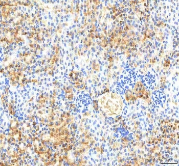 IHC staining of FFPE mouse kidney tissue with Pyridoxal kinase antibody. HIER: boil tissue sections in pH8 EDTA for 20 min and allow to cool before testing.