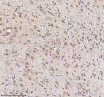 IHC staining of FFPE rat brain tissue (midbrain) with U1-70K antibody. HIER: boil tissue sections in pH8 EDTA for 20 min and allow to cool before testing.