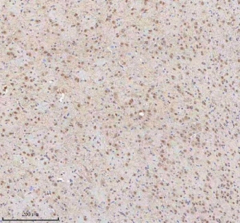 IHC staining of FFPE rat brain tissue (midbrain) with U1-70K antibody. HIER: boil tissue sections in pH8 EDTA for 20 min and allow to cool before testing.