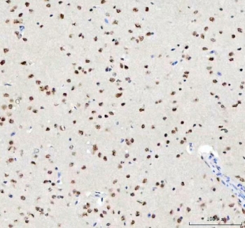 TARDBP Antibody Mouse Brain Tissue Immunohistochemistry. IHC staining of FFPE mouse brain tissue with TARDBP antibody. HIER: boil tissue sections in pH8 EDTA for 20 min and allow to cool before testing.